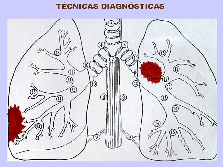 TÉCNICAS DIAGNÓSTICAS 