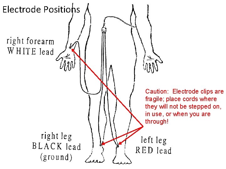 Electrode Positions Caution: Electrode clips are fragile; place cords where they will not be