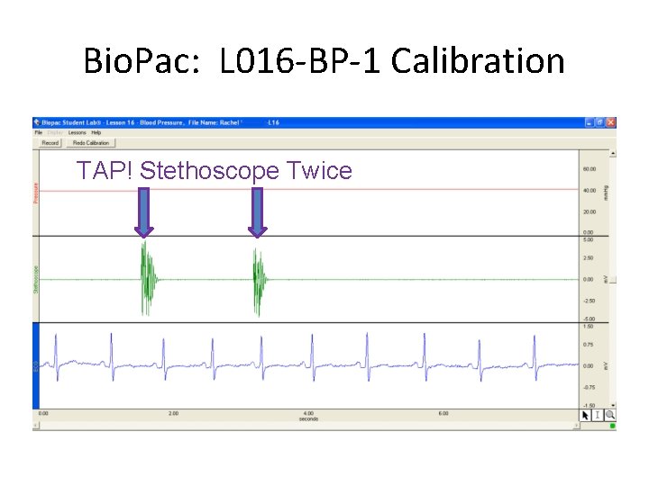 Bio. Pac: L 016 -BP-1 Calibration TAP! Stethoscope Twice 