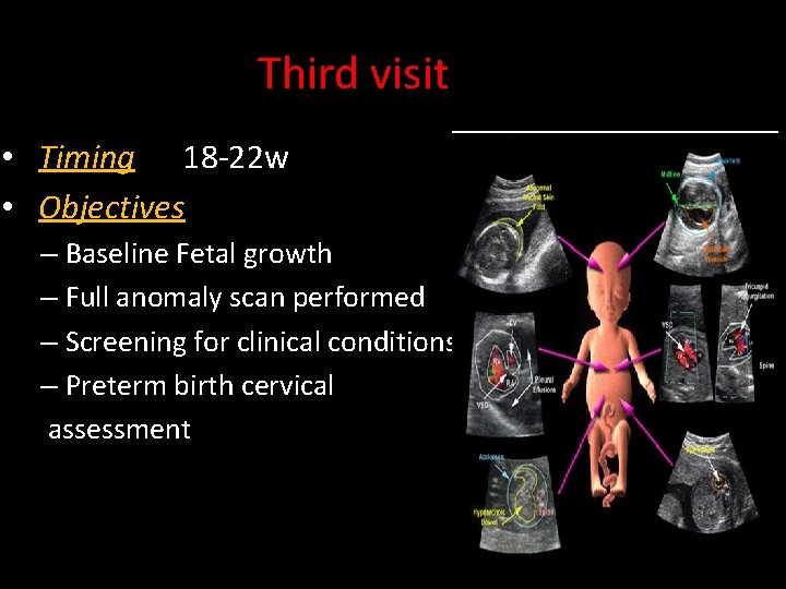 Third visit • Timing 18 -22 w • Objectives – Baseline Fetal growth –