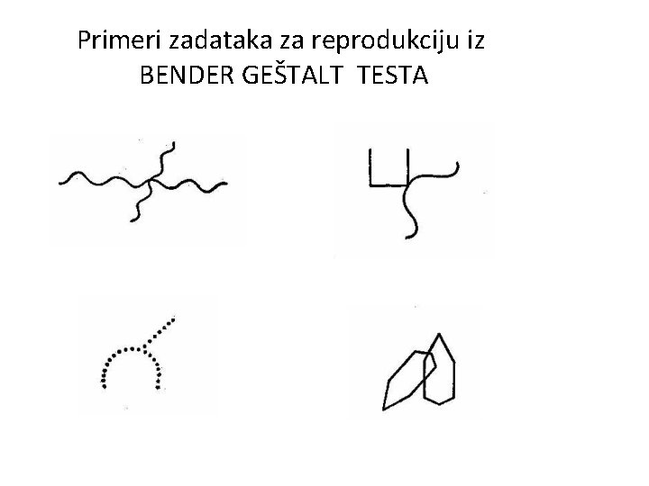 Primeri zadataka za reprodukciju iz BENDER GEŠTALT TESTA 