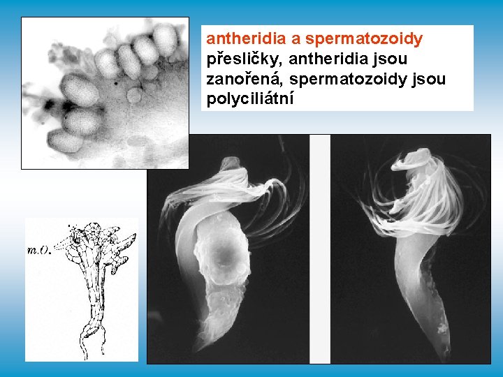 antheridia a spermatozoidy přesličky, antheridia jsou zanořená, spermatozoidy jsou polyciliátní 