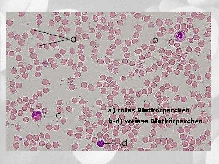 a) rotes Blutkörperchen b-d) weisse Blutkörperchen 