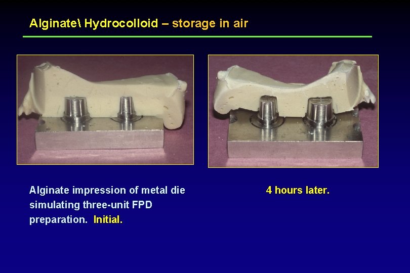 Alginate Hydrocolloid – storage in air Alginate impression of metal die simulating three-unit FPD