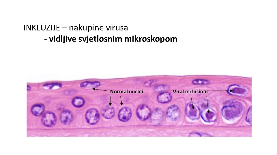 INKLUZIJE – nakupine virusa - vidljive svjetlosnim mikroskopom 