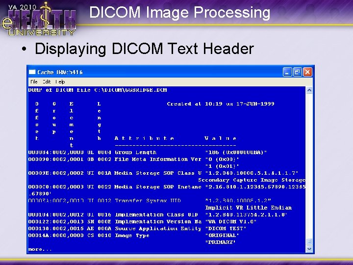 DICOM Image Processing • Displaying DICOM Text Header 