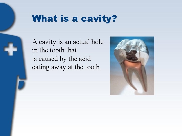What is a cavity? A cavity is an actual hole in the tooth that
