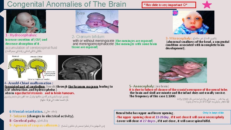 Congenital Anomalies of The Brain *This slide is very important * Extra 1 -