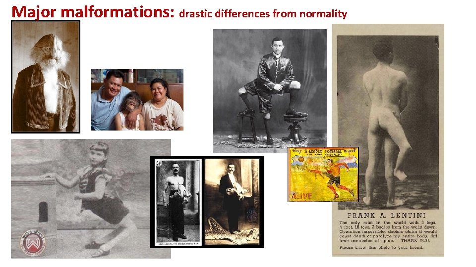 Major malformations: drastic differences from normality 