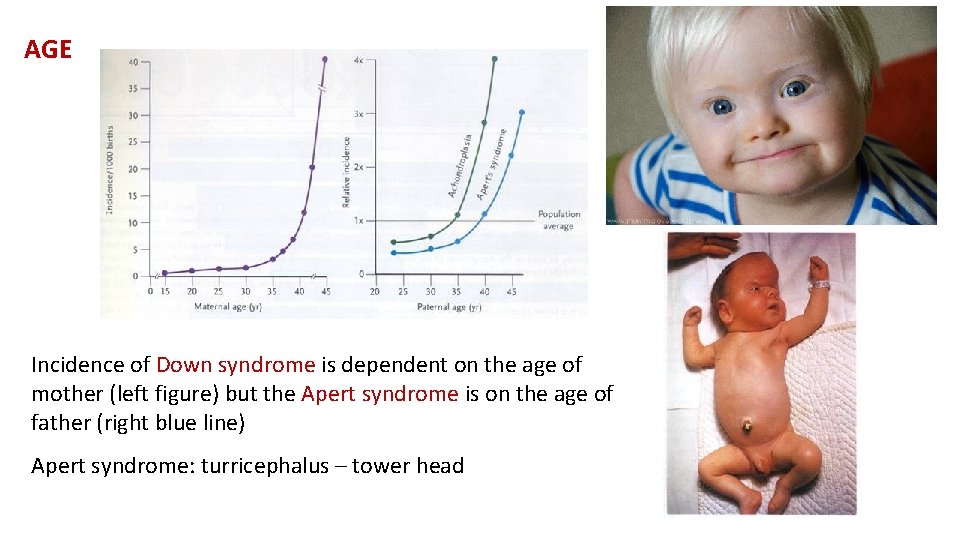 AGE Incidence of Down syndrome is dependent on the age of mother (left figure)