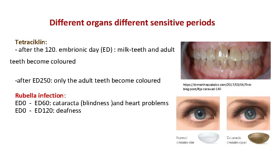 Different organs different sensitive periods Tetraciklin: - after the 120. embrionic day (ED) :