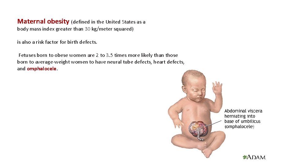 Maternal obesity (defined in the United States as a body mass index greater than