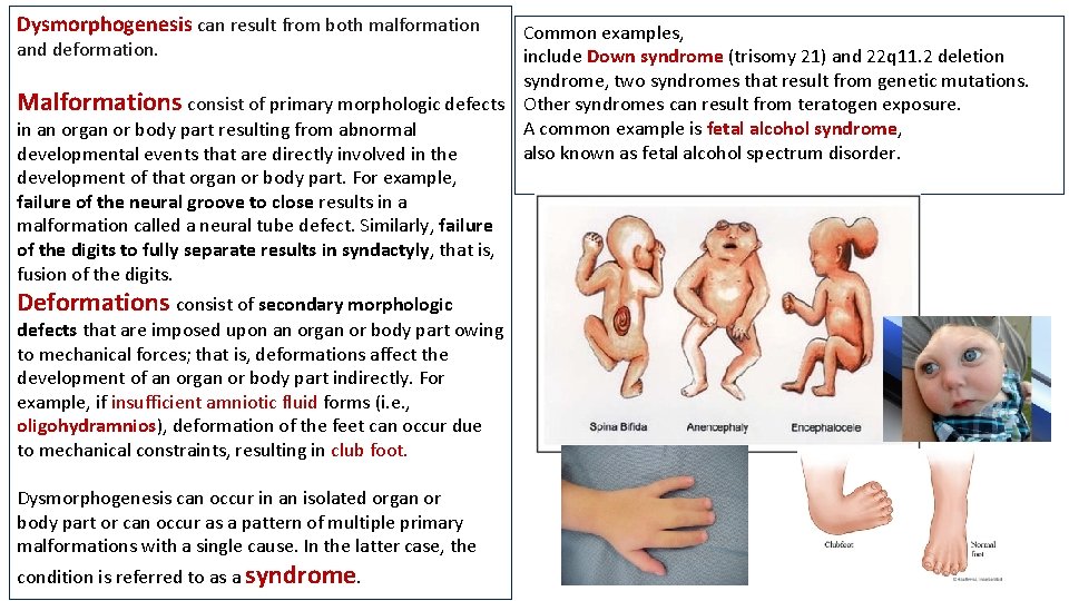 Dysmorphogenesis can result from both malformation Common examples, and deformation. include Down syndrome (trisomy