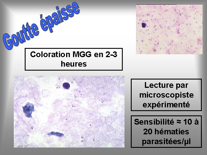 Coloration MGG en 2 -3 heures Lecture par microscopiste expérimenté Sensibilité ≈ 10 à
