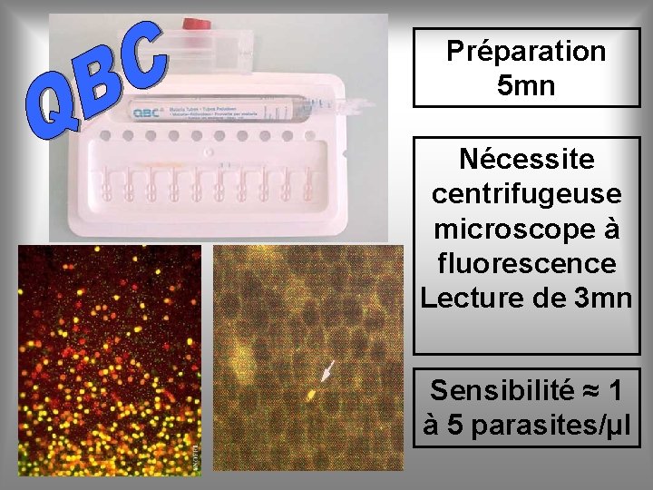 Préparation 5 mn Nécessite centrifugeuse microscope à fluorescence Lecture de 3 mn Sensibilité ≈