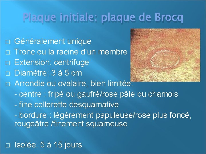 Plaque initiale: plaque de Brocq � Généralement unique Tronc ou la racine d’un membre