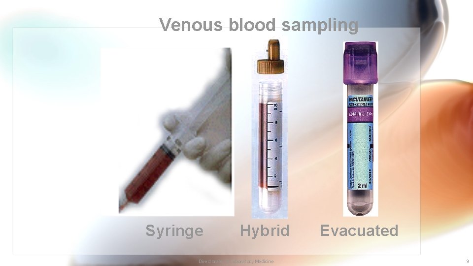 Venous blood sampling Syringe Hybrid Directorate of Laboratory Medicine Evacuated 9 