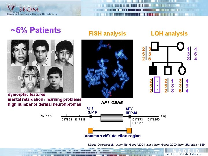 ~5% Patients FISH analysis LOH analysis 2 3 5 3 2 5 2 -
