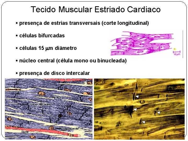 Tecido Muscular Estriado Cardiaco • presença de estrias transversais (corte longitudinal) • células bifurcadas