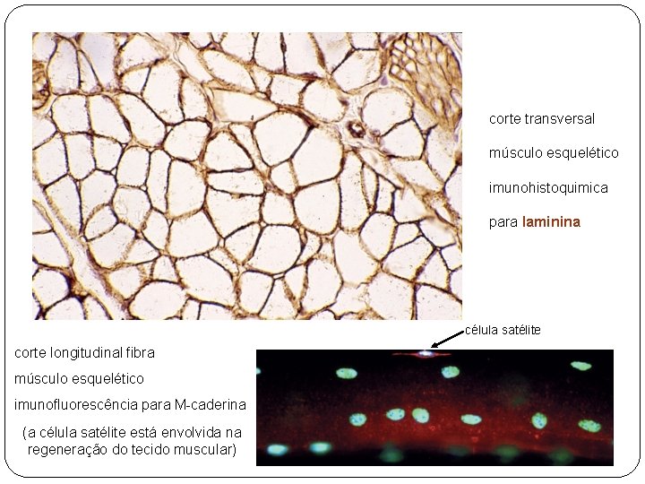 corte transversal músculo esquelético imunohistoquimica para laminina célula satélite corte longitudinal fibra músculo esquelético