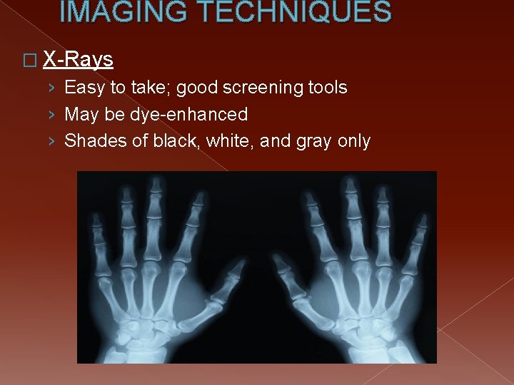 IMAGING TECHNIQUES � X-Rays › Easy to take; good screening tools › May be