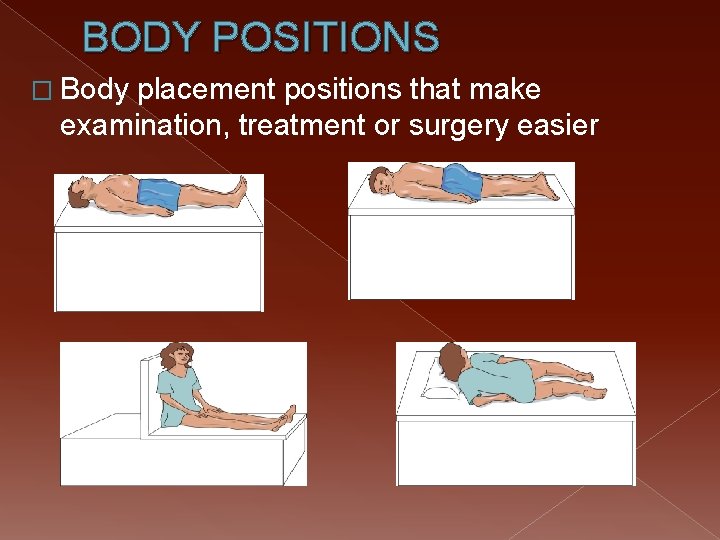 BODY POSITIONS � Body placement positions that make examination, treatment or surgery easier 