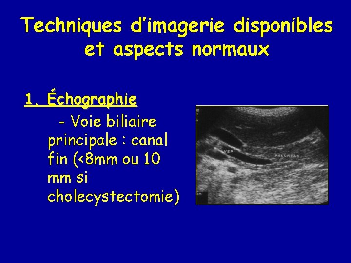 Techniques d’imagerie disponibles et aspects normaux 1. Échographie - Voie biliaire principale : canal