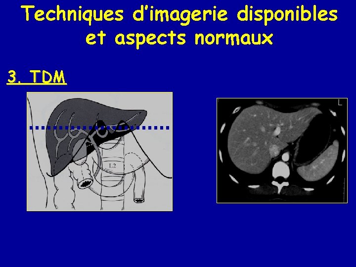 Techniques d’imagerie disponibles et aspects normaux 3. TDM 