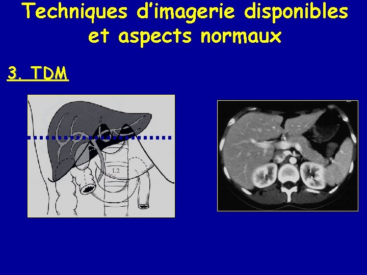 Techniques d’imagerie disponibles et aspects normaux 3. TDM 