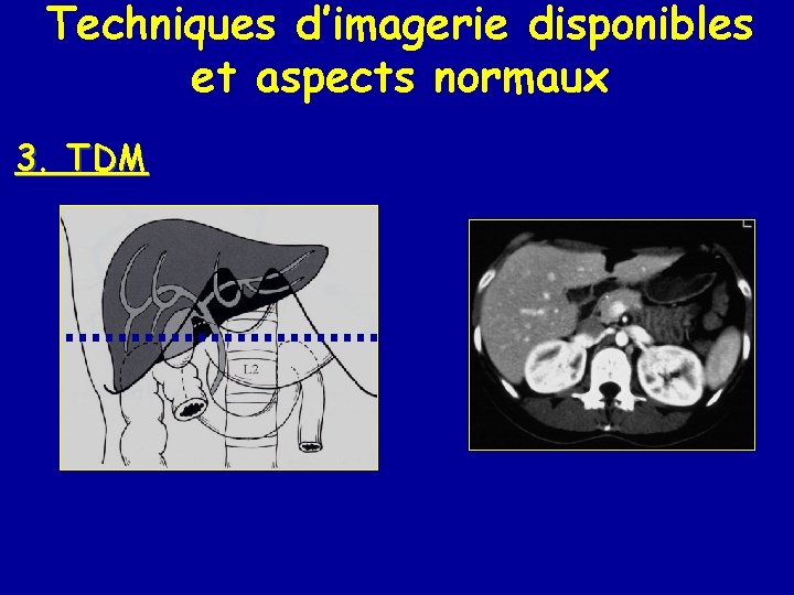 Techniques d’imagerie disponibles et aspects normaux 3. TDM 
