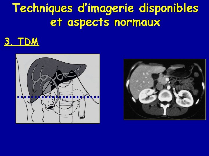 Techniques d’imagerie disponibles et aspects normaux 3. TDM 
