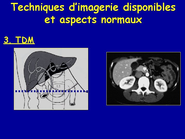 Techniques d’imagerie disponibles et aspects normaux 3. TDM 
