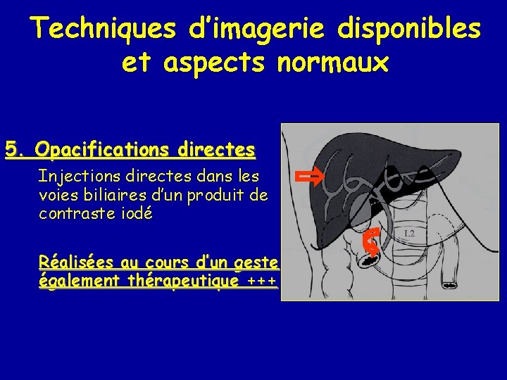 Techniques d’imagerie disponibles et aspects normaux 5. Opacifications directes Injections directes dans les voies