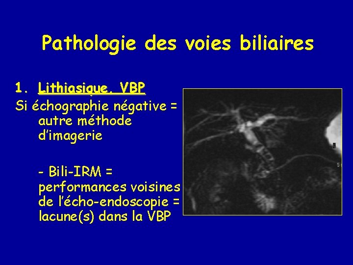 Pathologie des voies biliaires 1. Lithiasique, VBP Si échographie négative = autre méthode d’imagerie