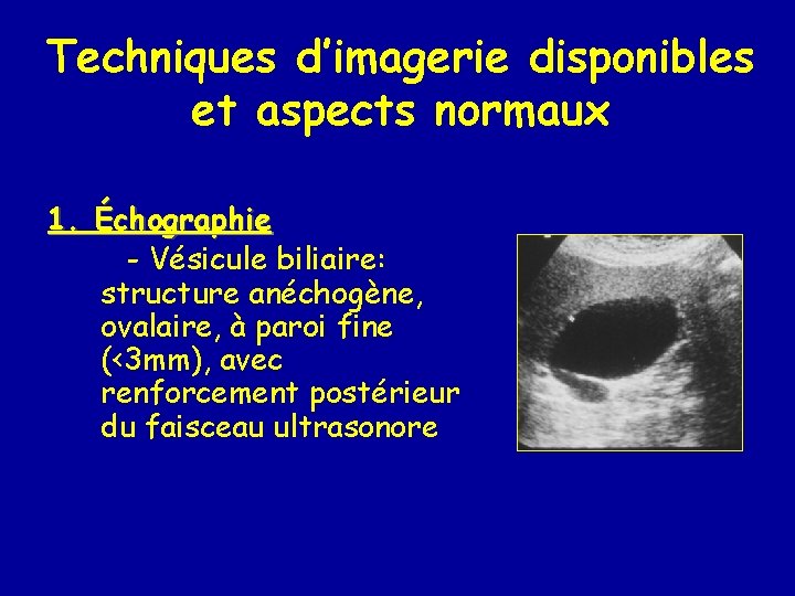 Techniques d’imagerie disponibles et aspects normaux 1. Échographie - Vésicule biliaire: structure anéchogène, ovalaire,