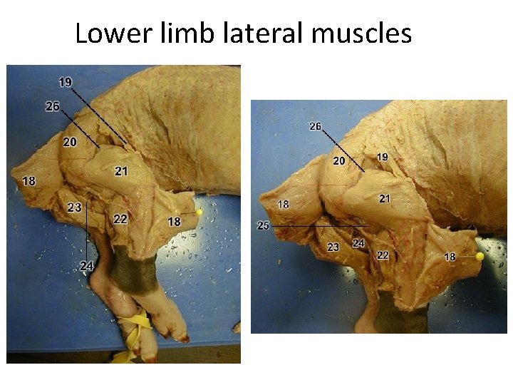Lower limb lateral muscles 