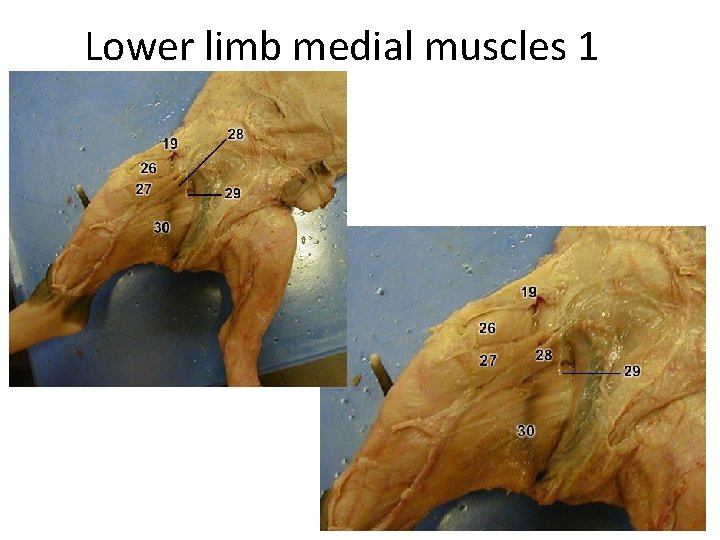 Lower limb medial muscles 1 