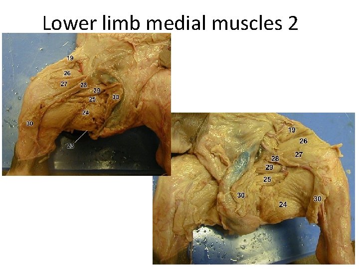 Lower limb medial muscles 2 