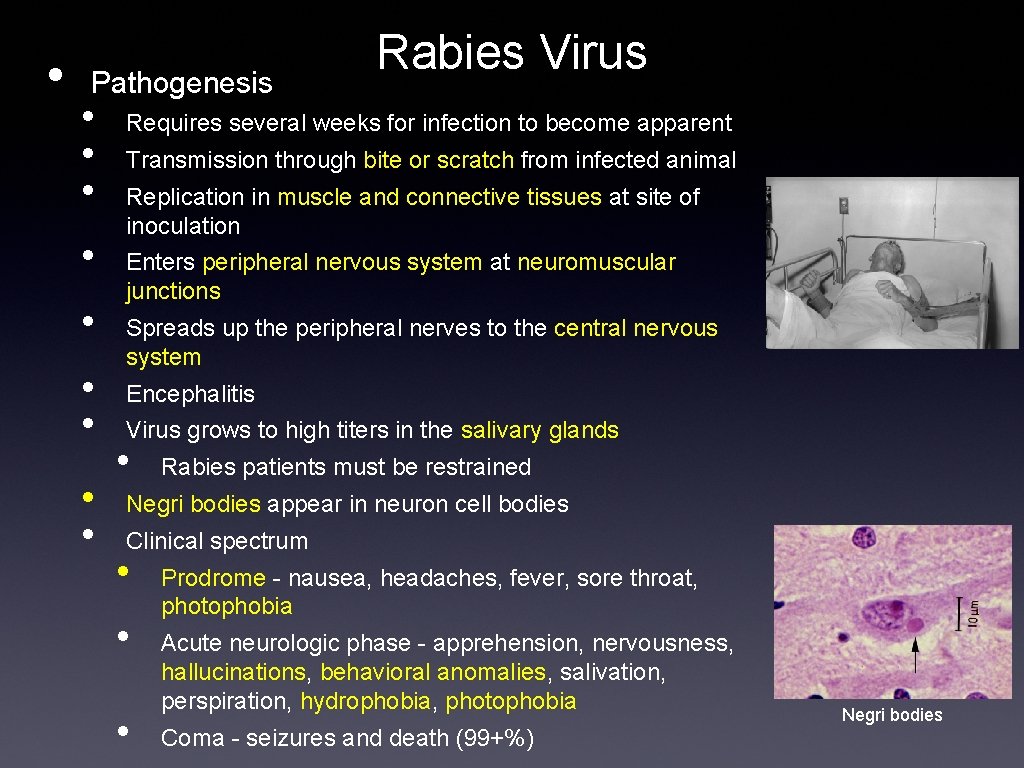  • Pathogenesis • • • Rabies Virus Requires several weeks for infection to