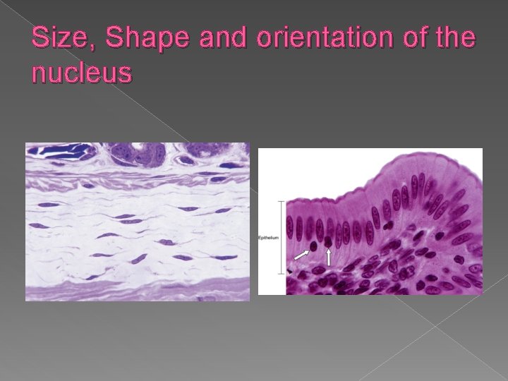 Size, Shape and orientation of the nucleus 
