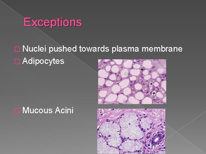 Exceptions � Nuclei pushed towards plasma membrane � Adipocytes � Mucous Acini 