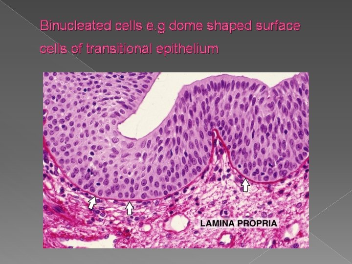 Binucleated cells e. g dome shaped surface cells of transitional epithelium 