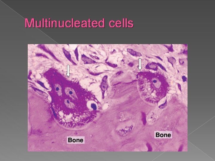 Multinucleated cells 