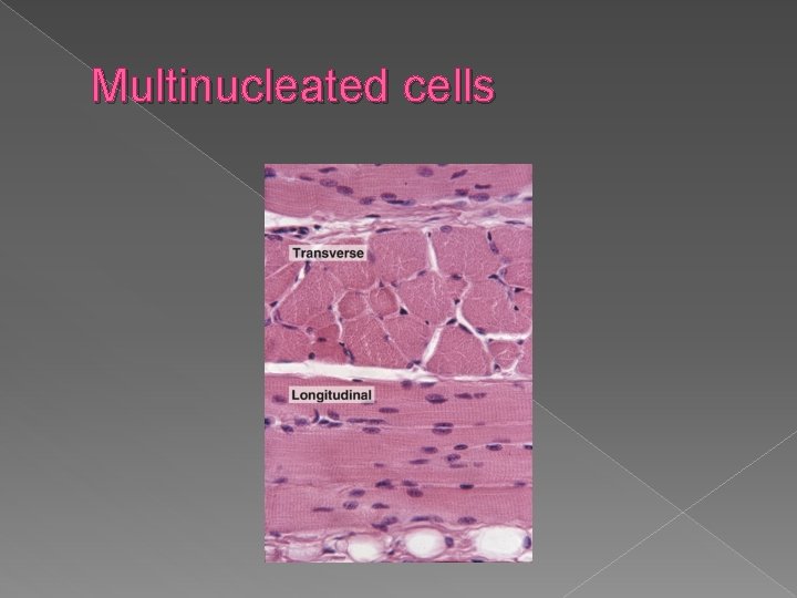 Multinucleated cells 