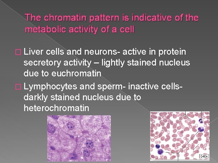 The chromatin pattern is indicative of the metabolic activity of a cell � Liver
