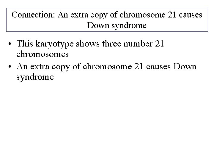 Connection: An extra copy of chromosome 21 causes Down syndrome • This karyotype shows