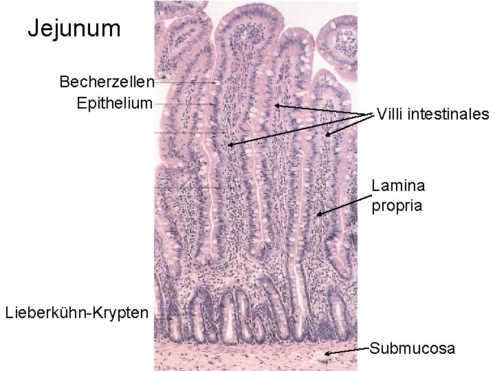 Jejunum Becherzellen Epithelium Villi intestinales Lamina propria Lieberkühn-Krypten Submucosa 