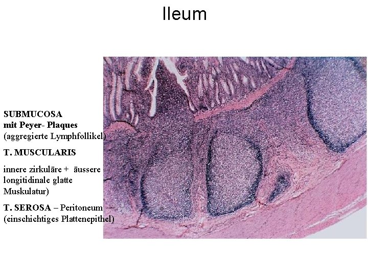 Ileum SUBMUCOSA mit Peyer- Plaques (aggregierte Lymphfollikel) T. MUSCULARIS innere zirkuläre + äussere longitidinale