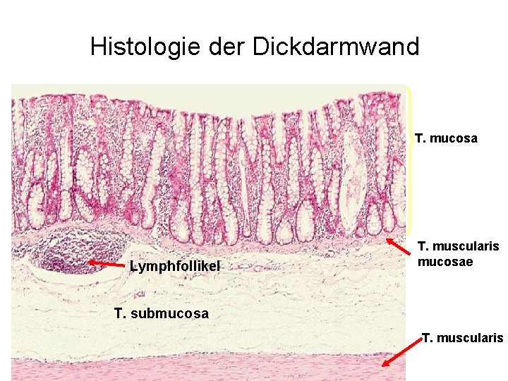 Histologie der Dickdarmwand T. mucosa Lymphfollikel T. muscularis mucosae T. submucosa T. muscularis 