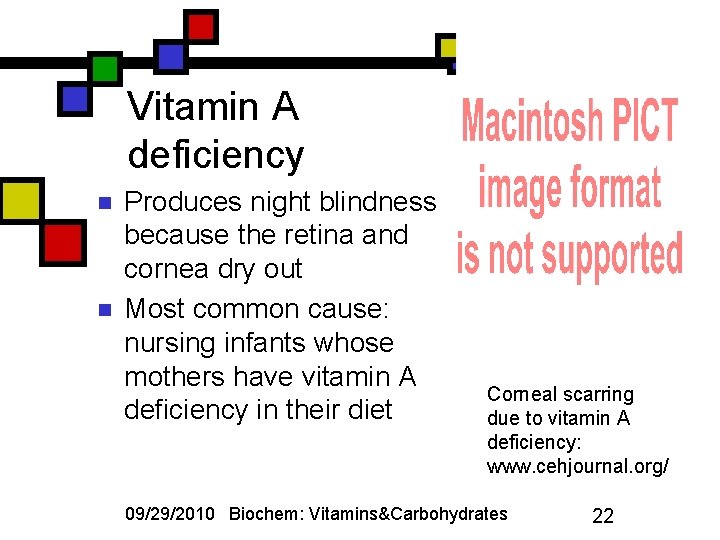 Vitamin A deficiency n n Produces night blindness because the retina and cornea dry